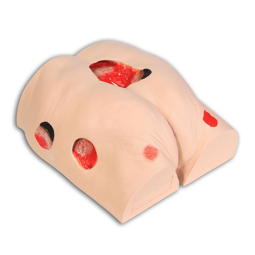 Wound Care