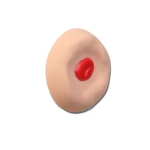 0333_recessed-stoma-1000×1000