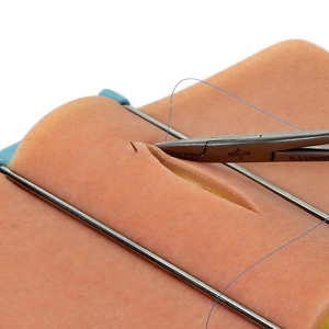 Suture/Surgical
